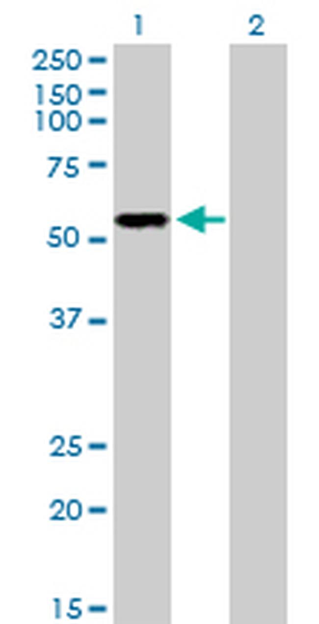 P2RX5 Antibody in Western Blot (WB)