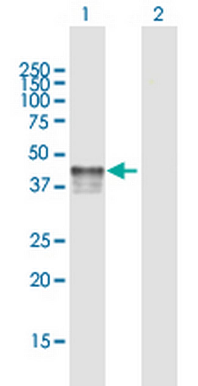 P2RY2 Antibody in Western Blot (WB)