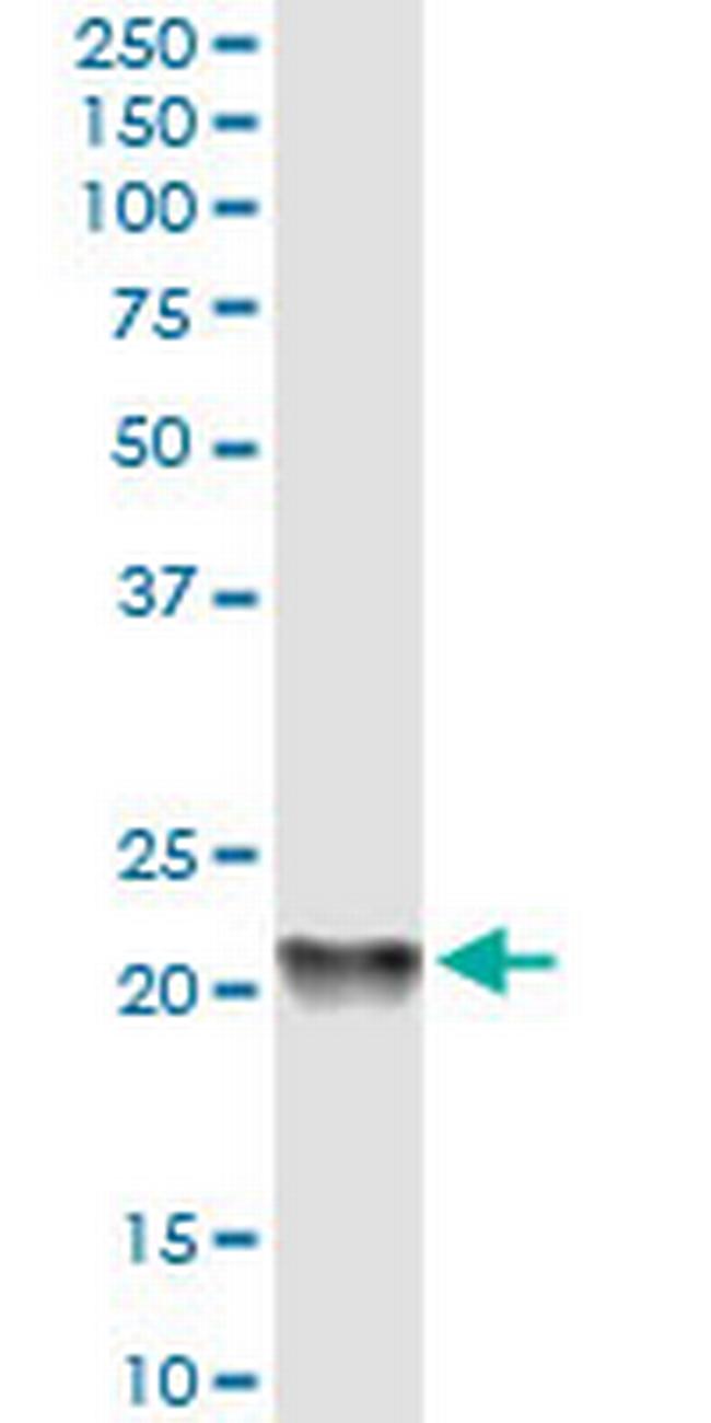 PBP Antibody in Western Blot (WB)