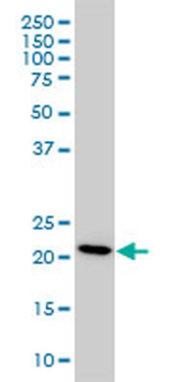 PBP Antibody in Western Blot (WB)