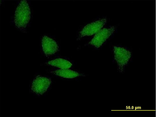 PABPC3 Antibody in Immunocytochemistry (ICC/IF)