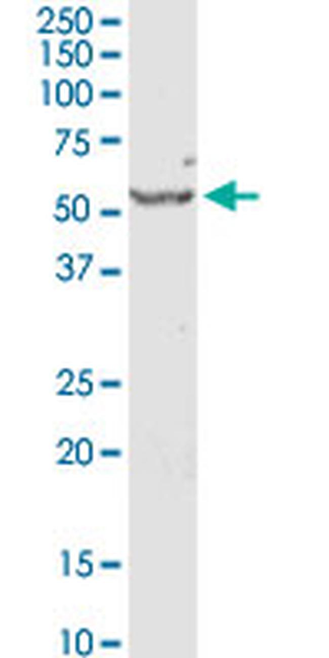 SERPINE1 Antibody in Western Blot (WB)