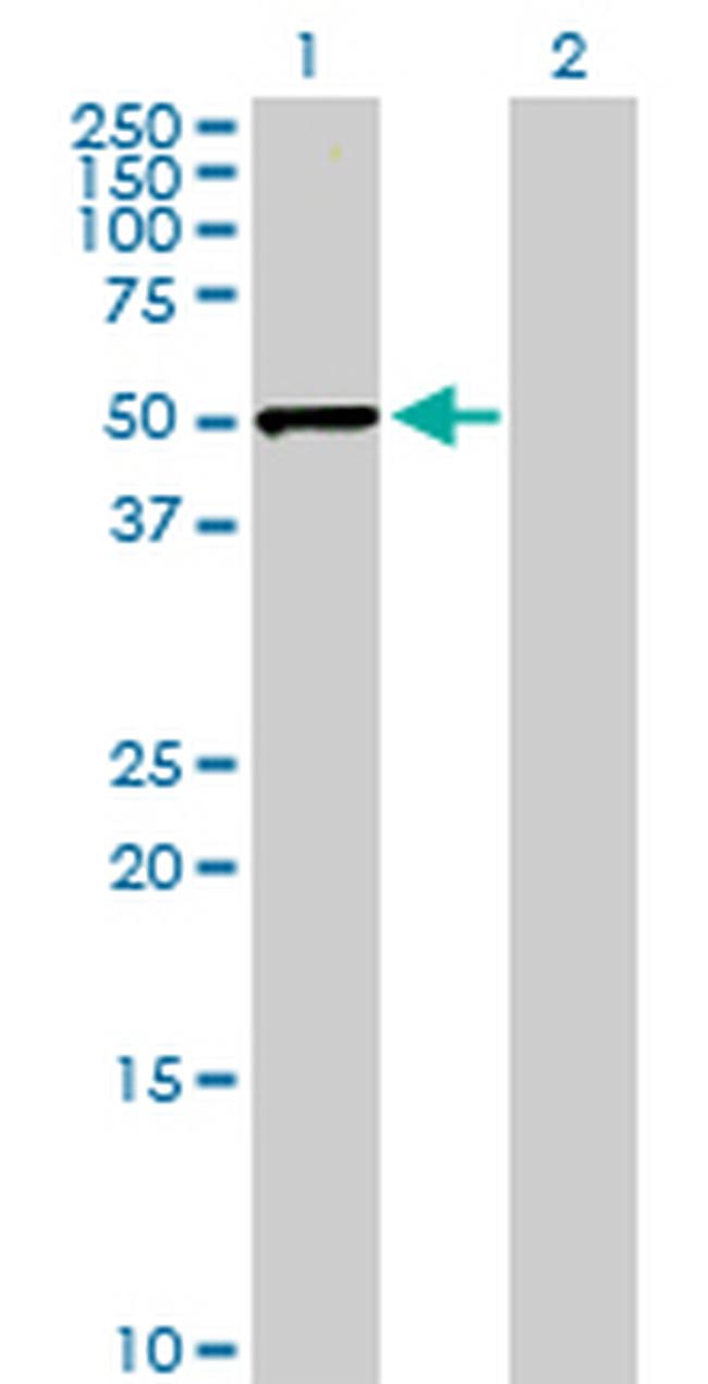 SERPINE1 Antibody in Western Blot (WB)