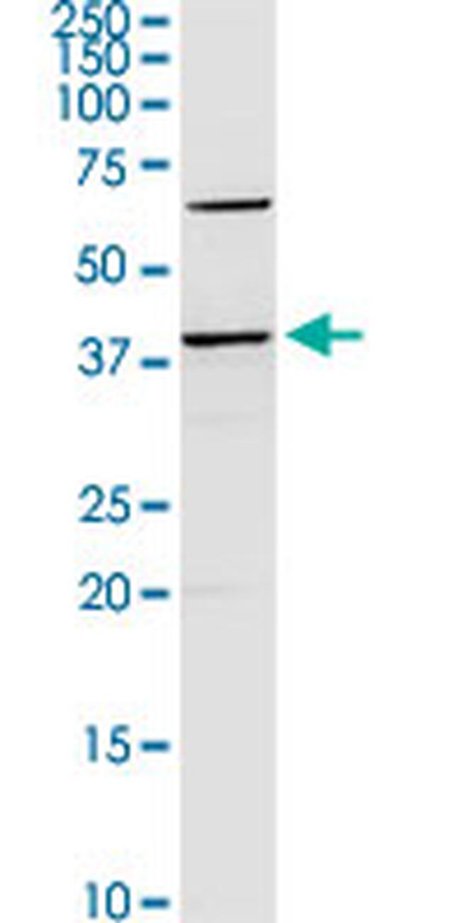 SERPINB2 Antibody in Western Blot (WB)