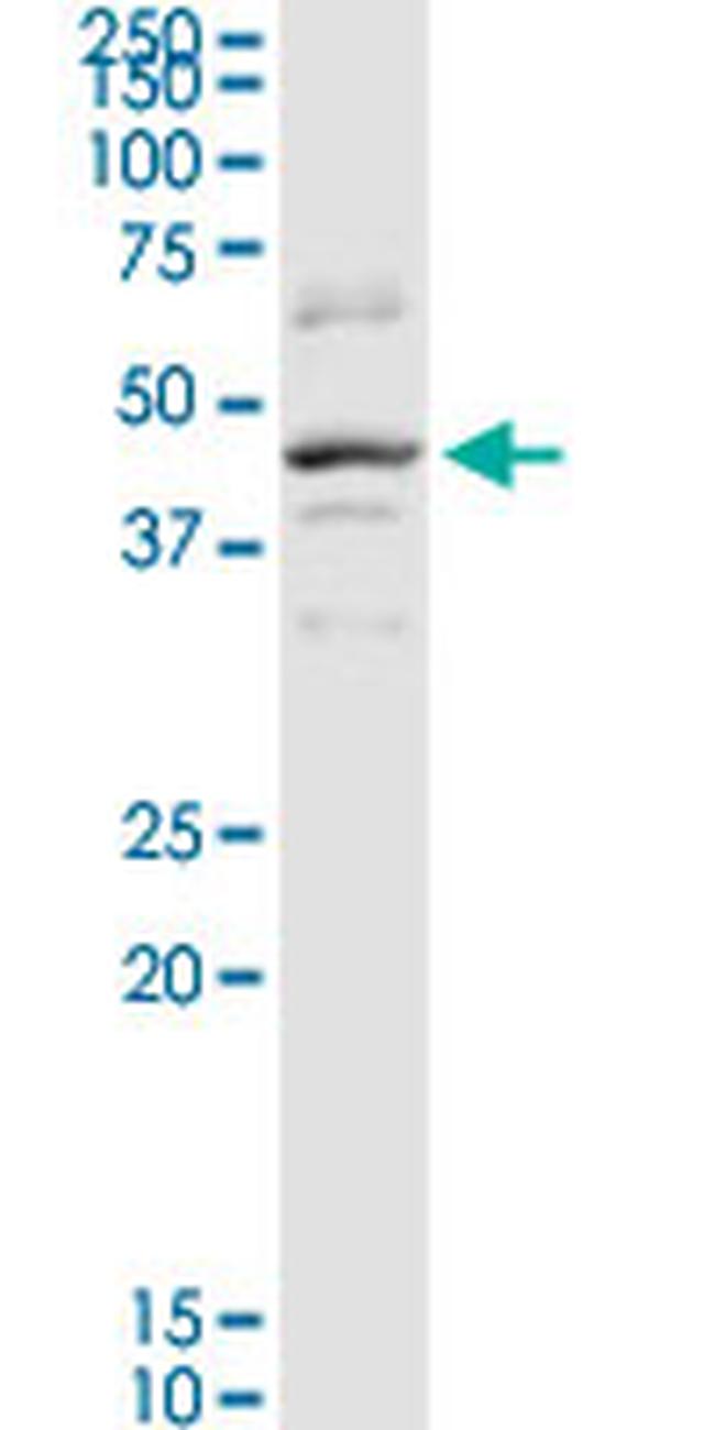 SERPINB2 Antibody in Western Blot (WB)