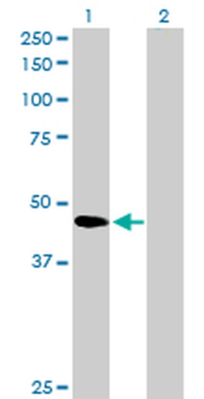 SERPINB2 Antibody in Western Blot (WB)