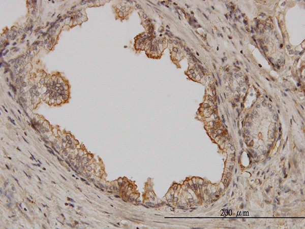 PAK1 Antibody in Immunohistochemistry (Paraffin) (IHC (P))