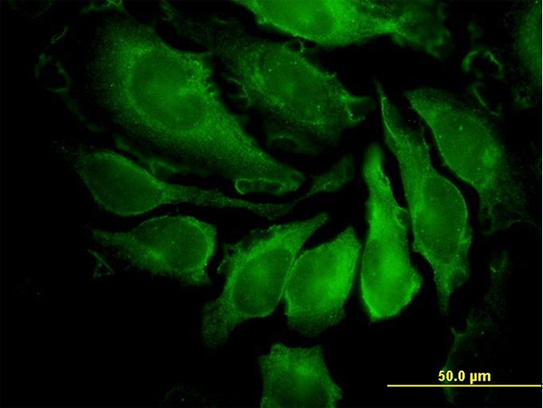 PAK1 Antibody in Immunocytochemistry (ICC/IF)