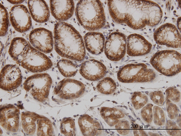 PAK1 Antibody in Immunohistochemistry (Paraffin) (IHC (P))