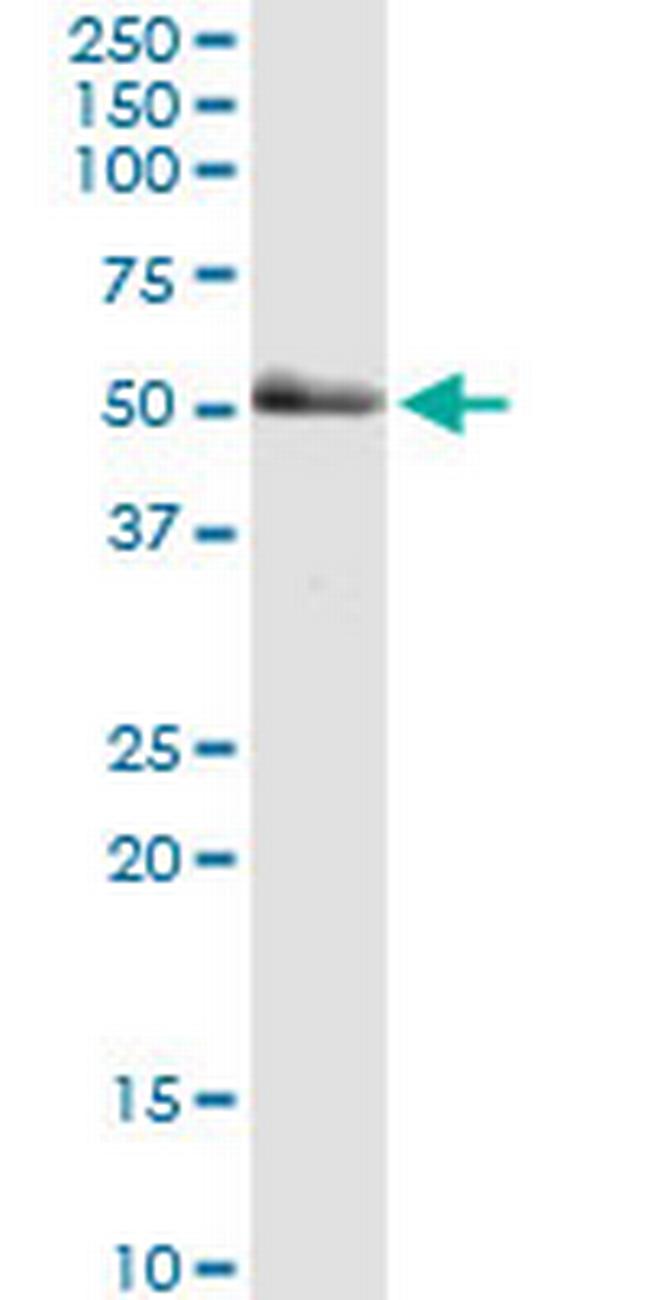 PAK2 Antibody in Western Blot (WB)