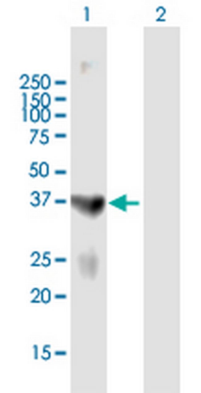 PARK2 Antibody in Western Blot (WB)