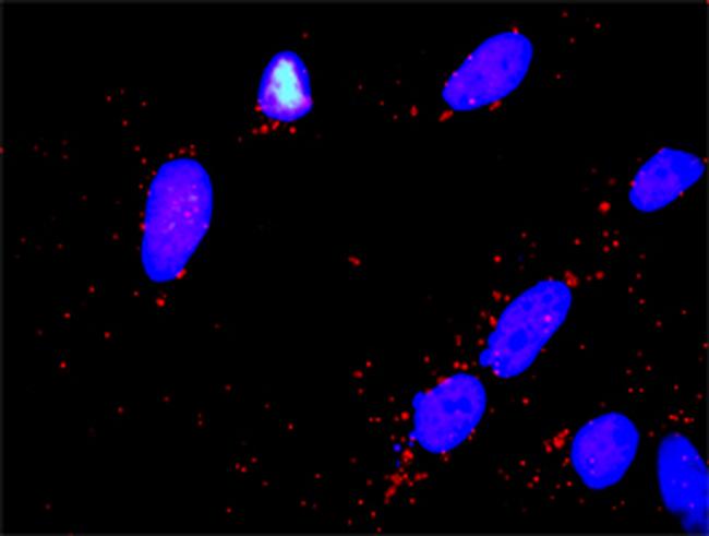 PARK2 Antibody in Proximity Ligation Assay (PLA) (PLA)