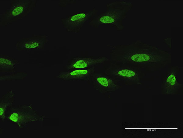 PAX2 Antibody in Immunocytochemistry (ICC/IF)