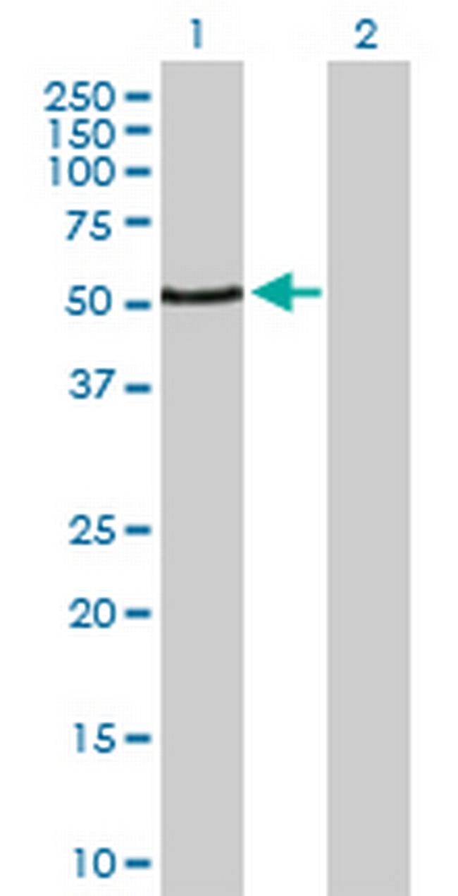 PAX3 Antibody in Western Blot (WB)