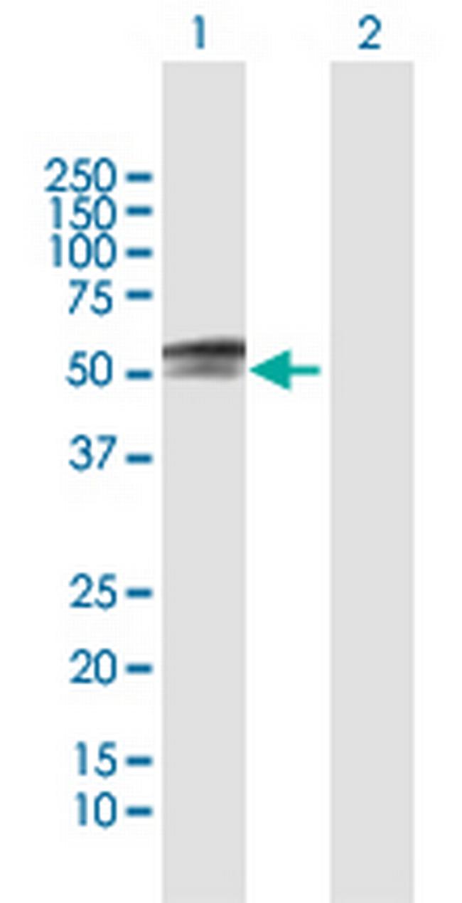 PAX3 Antibody in Western Blot (WB)