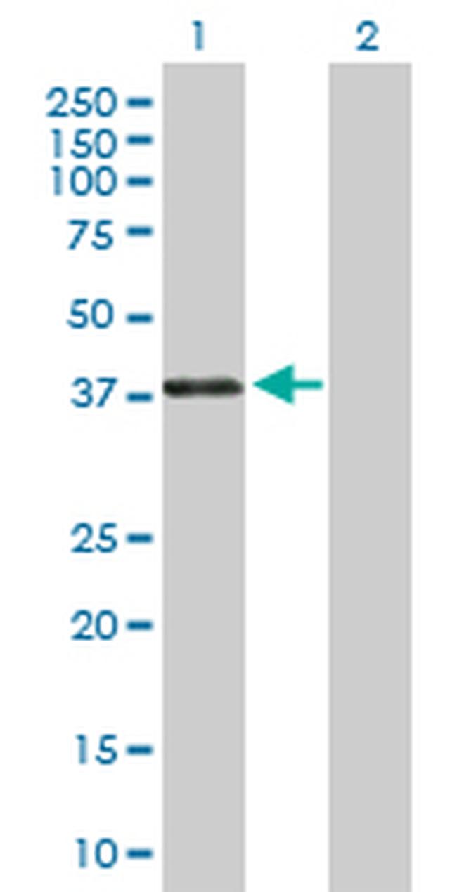 PAX4 Antibody in Western Blot (WB)