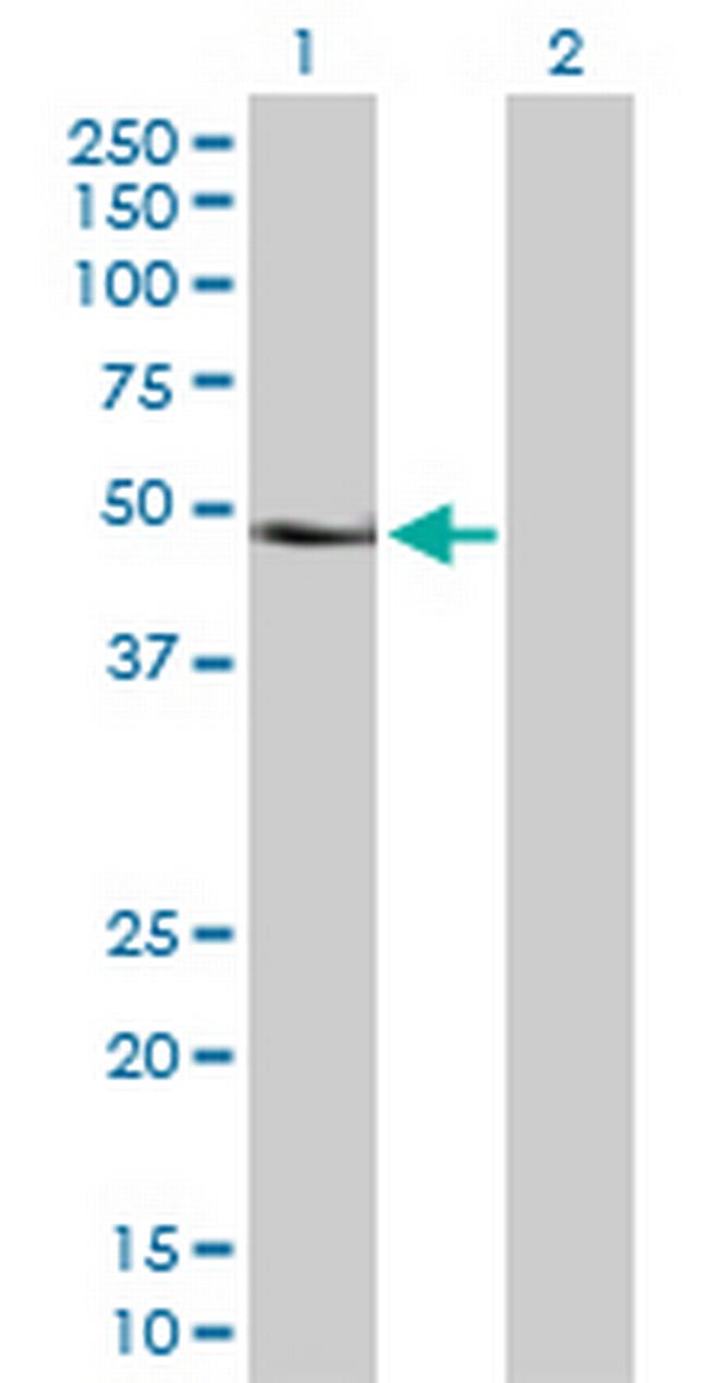 PAX6 Antibody in Western Blot (WB)