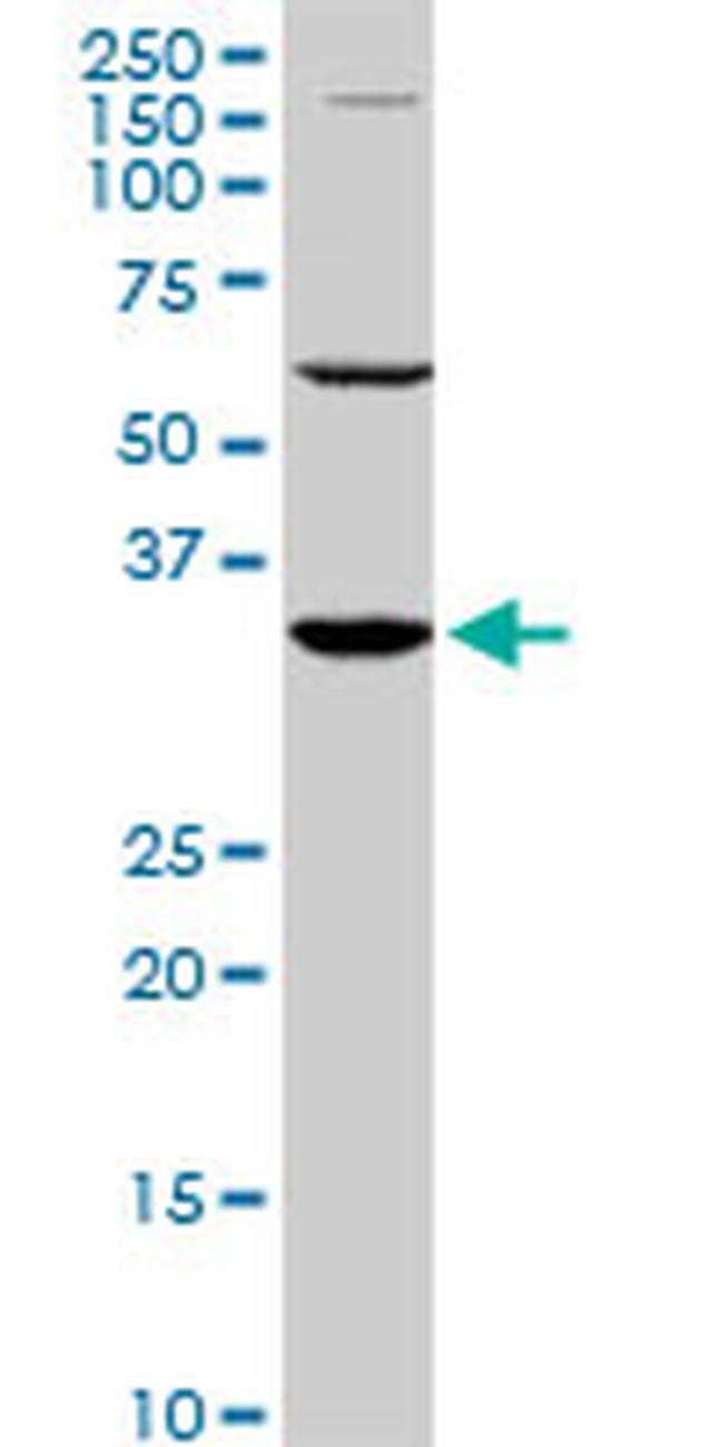 PAX9 Antibody in Western Blot (WB)