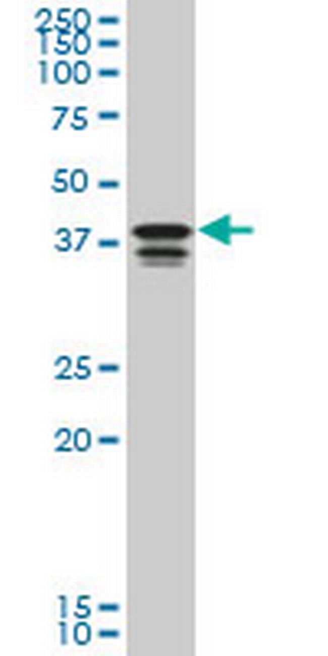PCBP2 Antibody in Western Blot (WB)