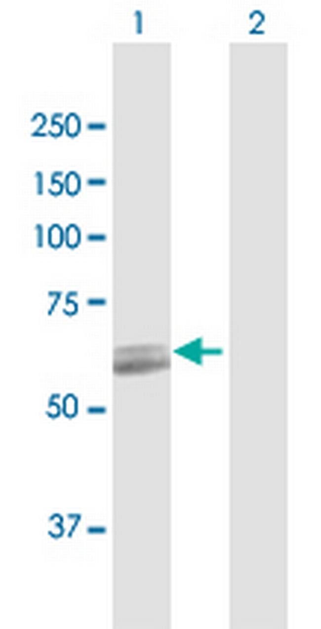 PCCB Antibody in Western Blot (WB)