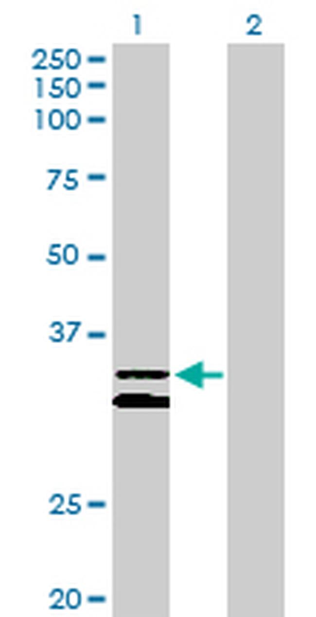 PCDH1 Antibody in Western Blot (WB)