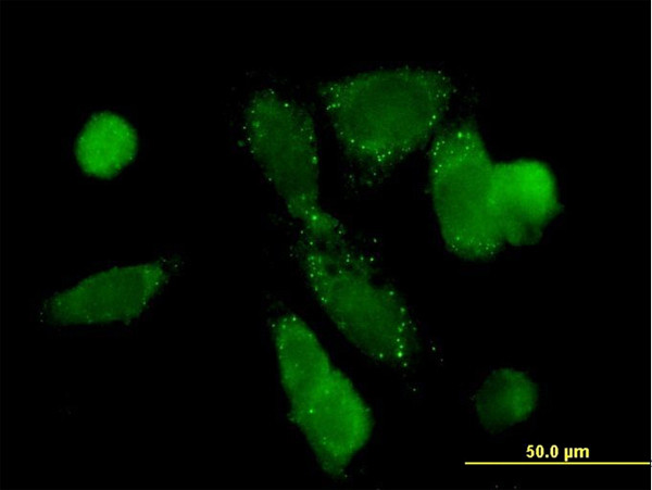 PCK1 Antibody in Immunocytochemistry (ICC/IF)