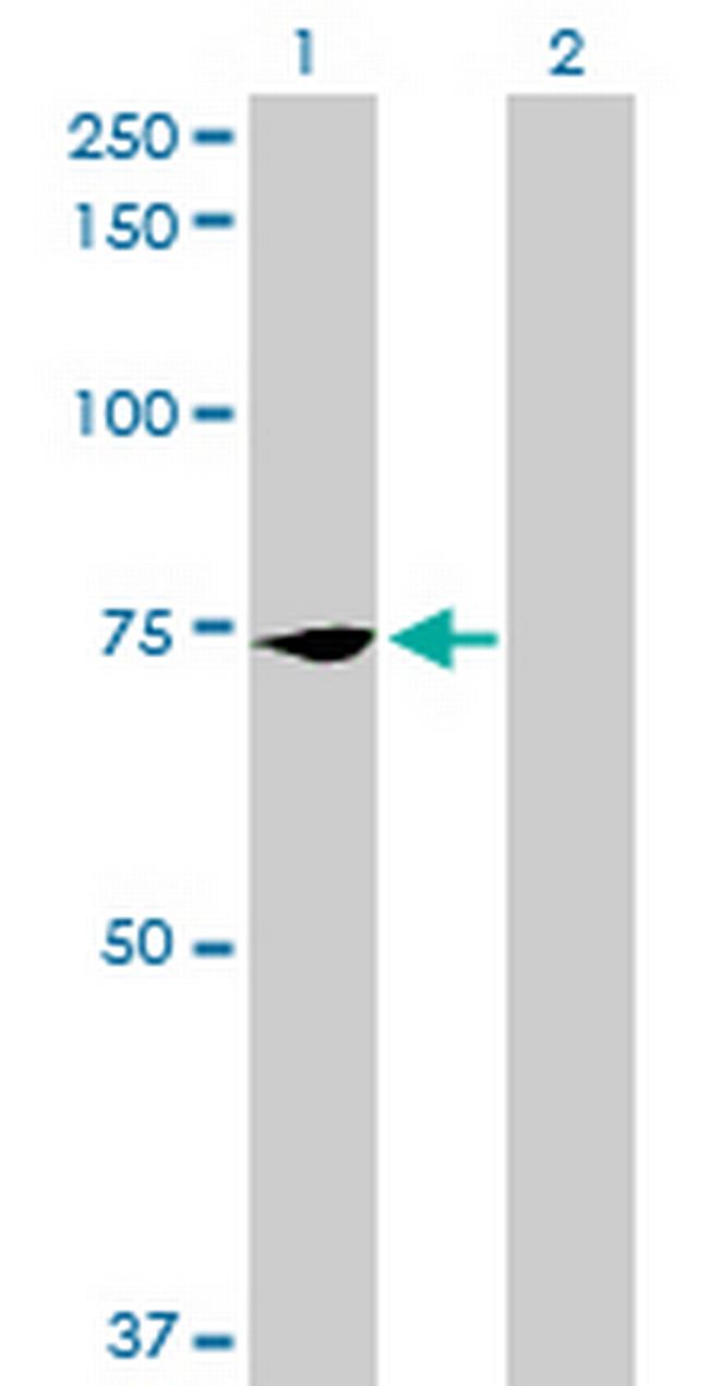 PCK2 Antibody in Western Blot (WB)