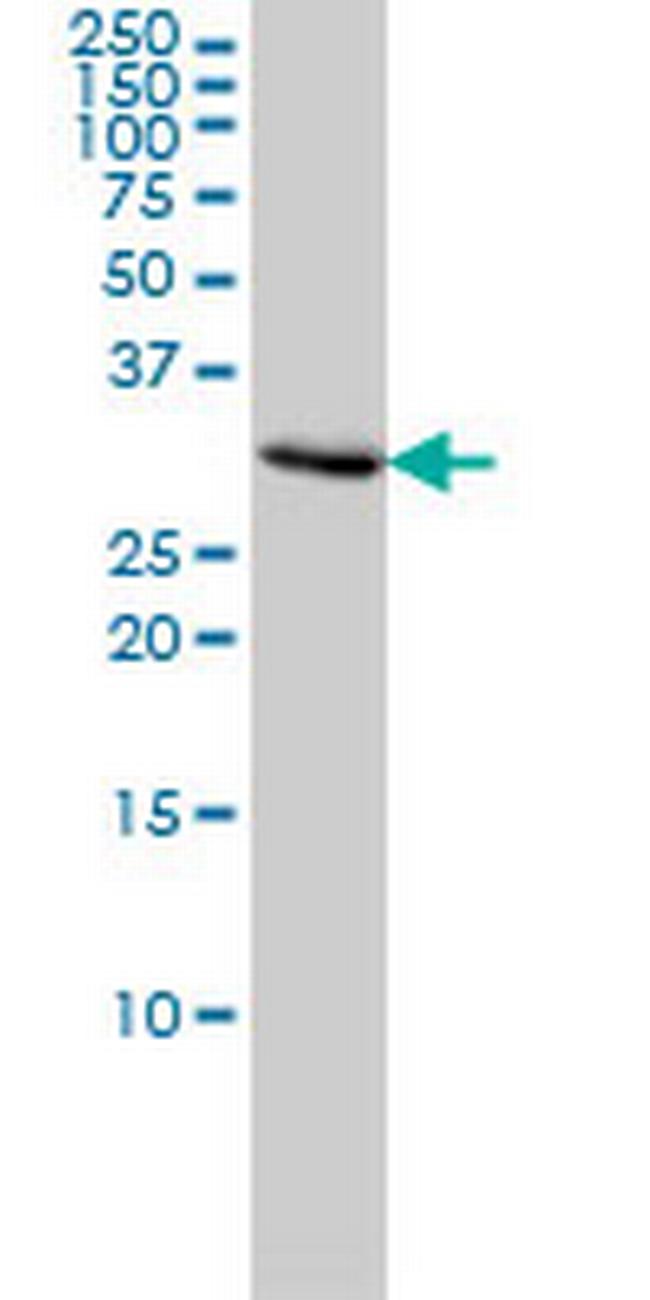 PCNA Antibody in Western Blot (WB)