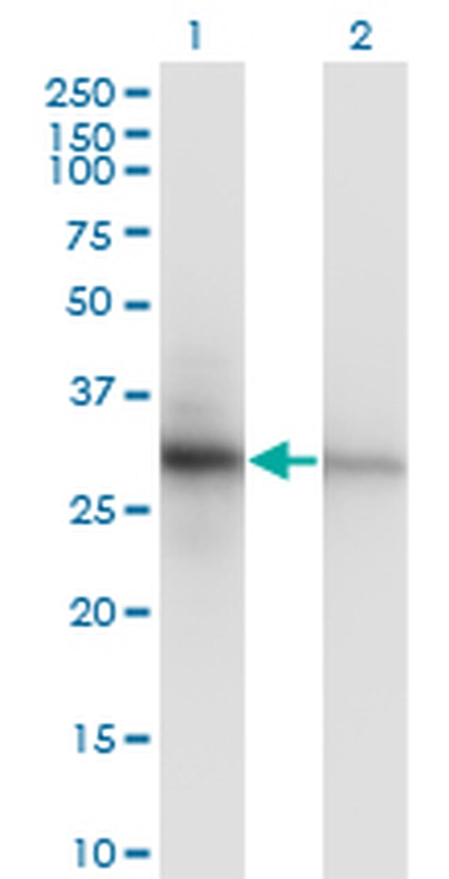 PCNA Antibody in Western Blot (WB)