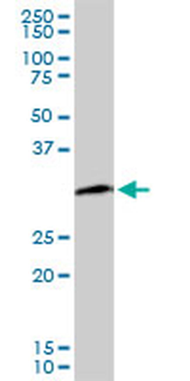 PCNA Antibody in Western Blot (WB)