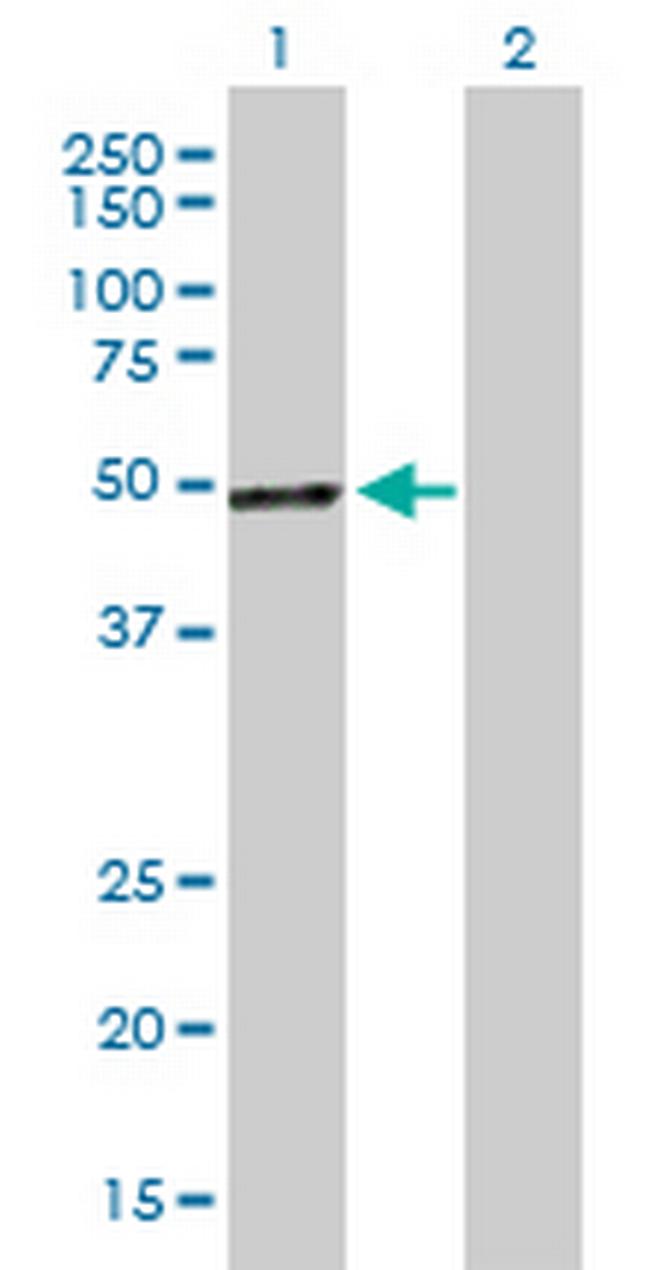 PCOLCE Antibody in Western Blot (WB)