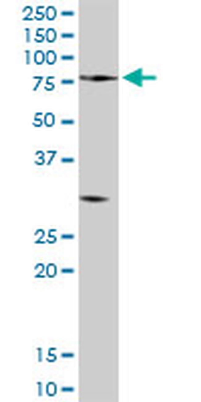 PCSK2 Antibody in Western Blot (WB)