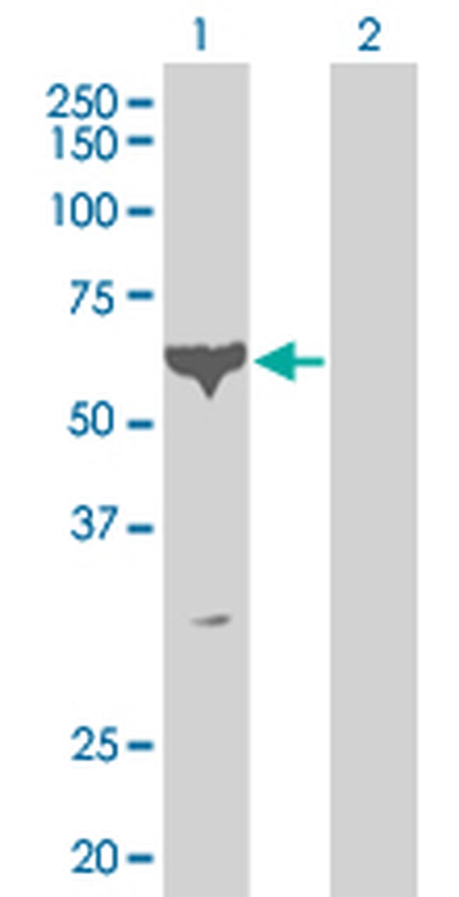 PCTK1 Antibody in Western Blot (WB)