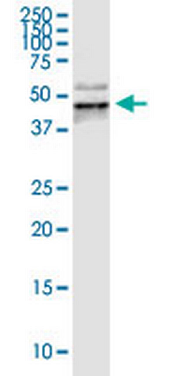 PDCD1 Antibody in Western Blot (WB)