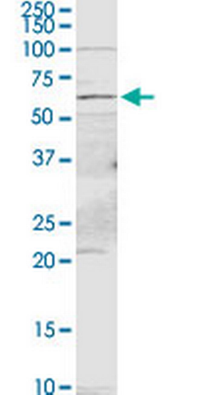 PDE9A Antibody in Western Blot (WB)