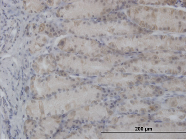 PDHA1 Antibody in Immunohistochemistry (Paraffin) (IHC (P))