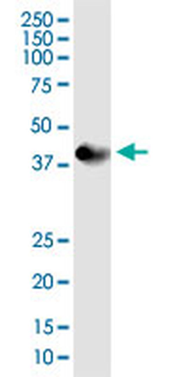 PDHA1 Antibody in Western Blot (WB)