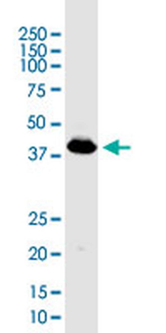 PDHA1 Antibody in Western Blot (WB)