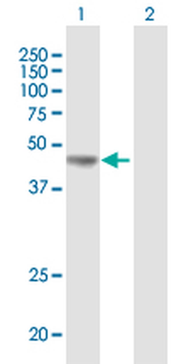 PDHA1 Antibody in Western Blot (WB)