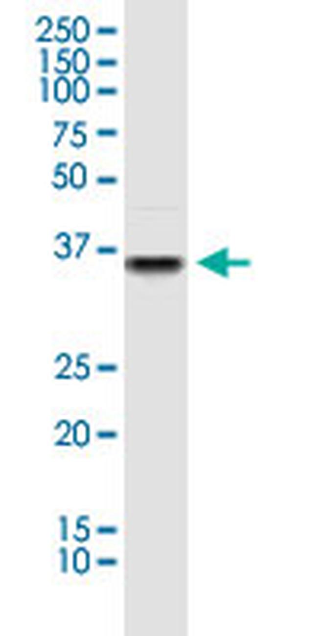 PDHA1 Antibody in Western Blot (WB)