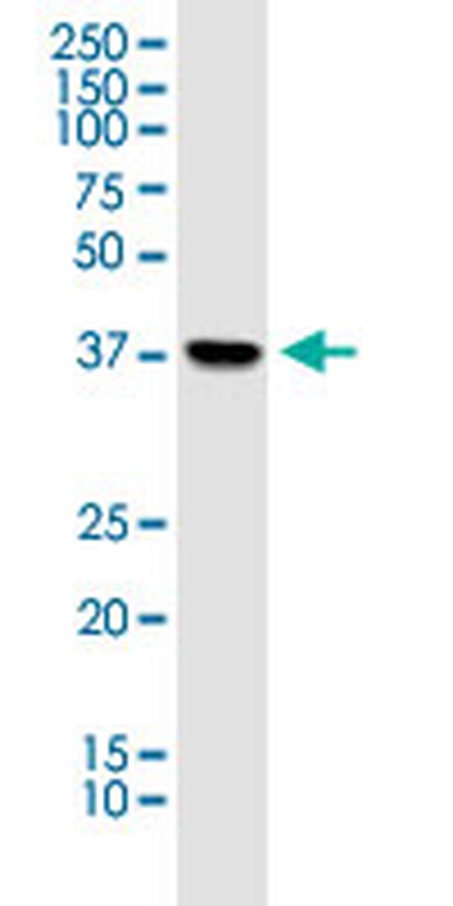 PDHA1 Antibody in Western Blot (WB)