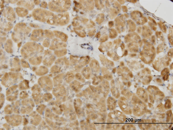 PDK2 Antibody in Immunohistochemistry (Paraffin) (IHC (P))