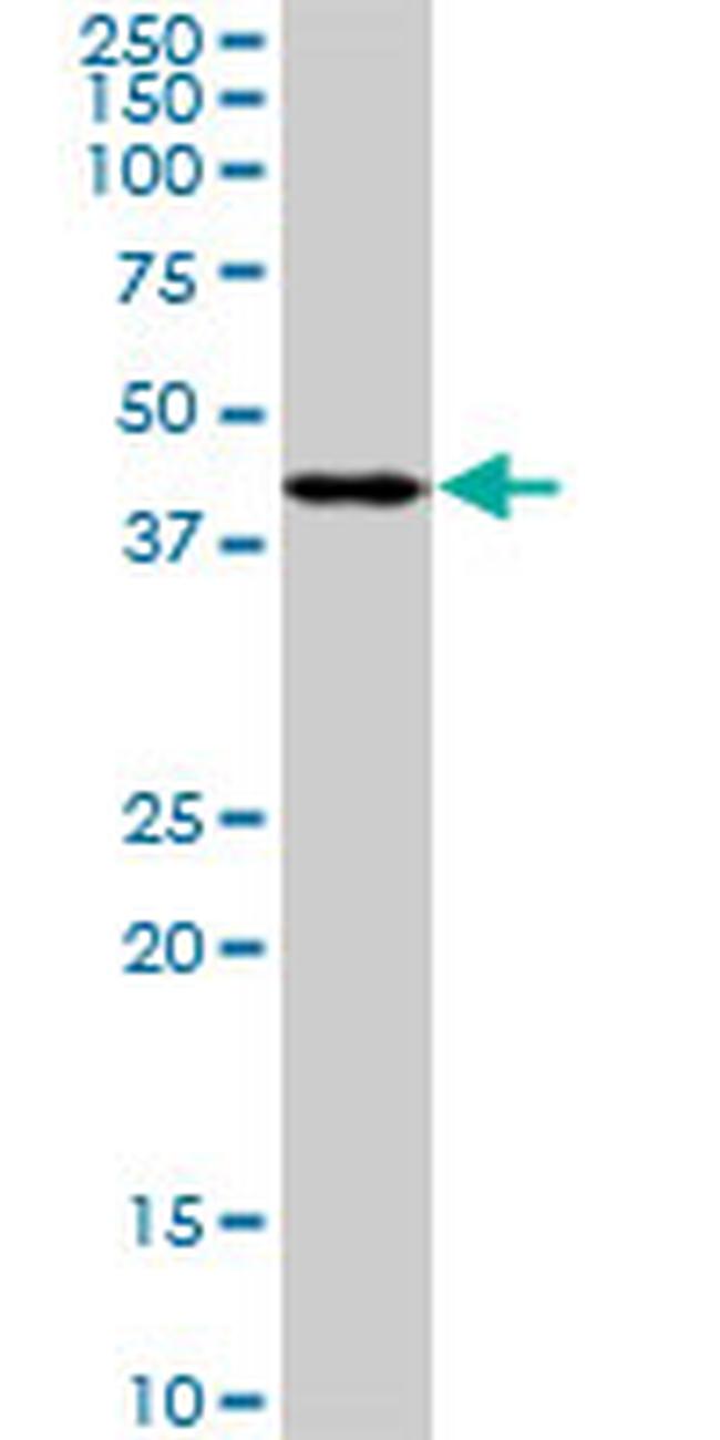 PDK2 Antibody in Western Blot (WB)