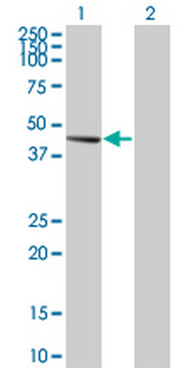 PDK2 Antibody in Western Blot (WB)