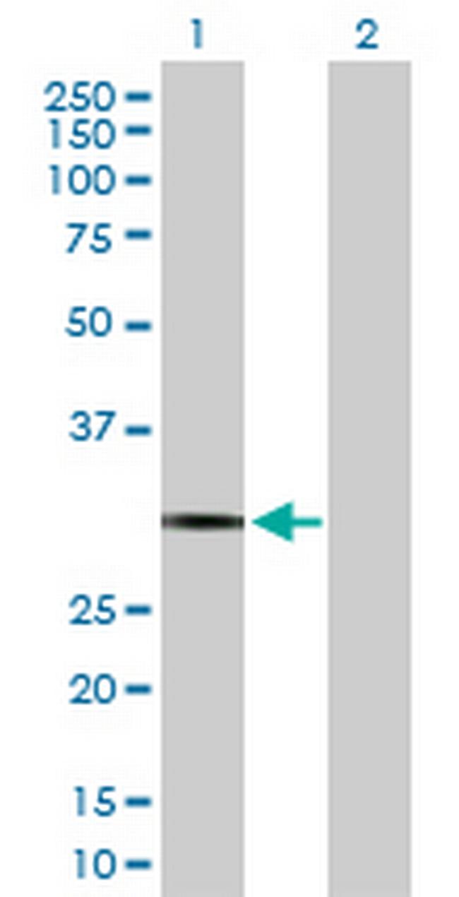 PDYN Antibody in Western Blot (WB)