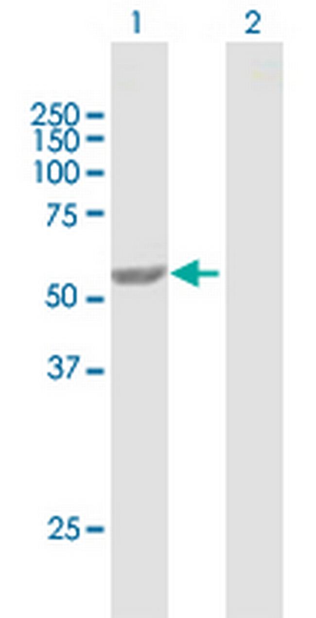 PEPD Antibody in Western Blot (WB)