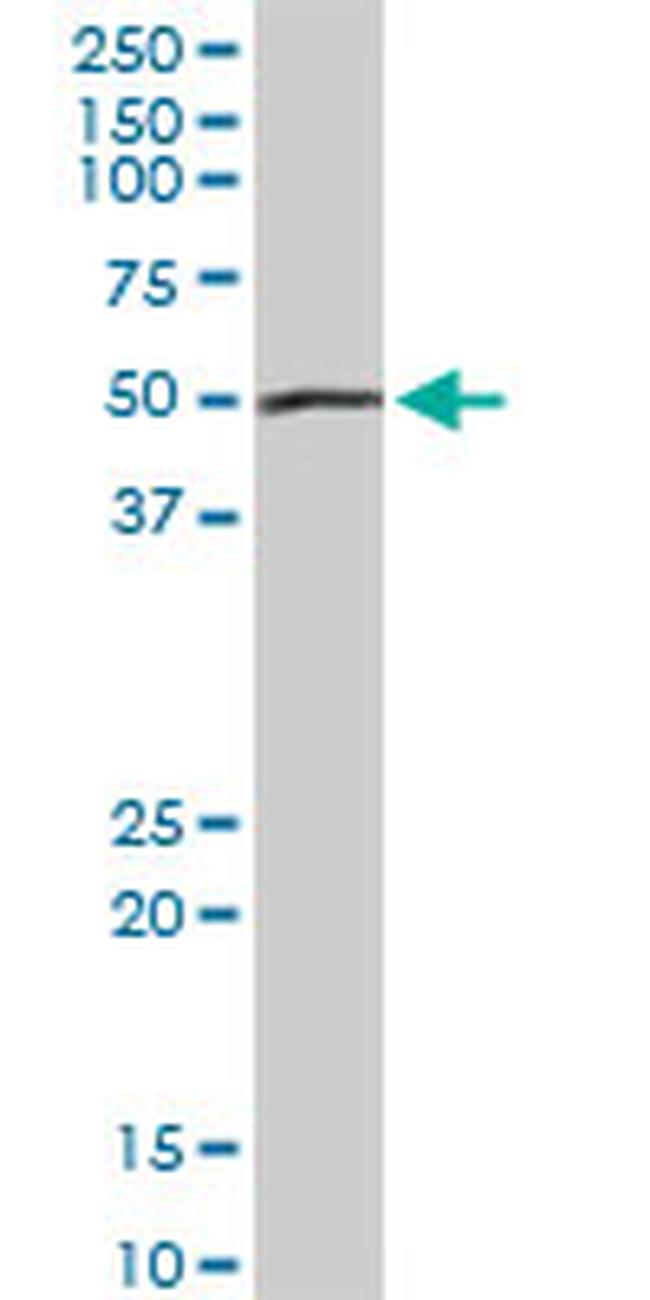 PEPD Antibody in Western Blot (WB)