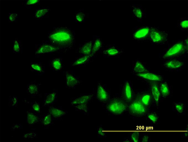 PEPD Antibody in Immunocytochemistry (ICC/IF)