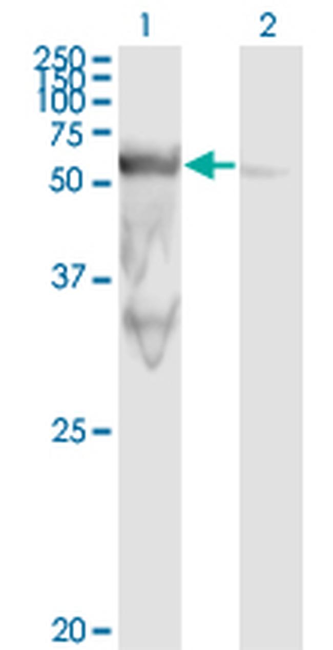 PEPD Antibody in Western Blot (WB)