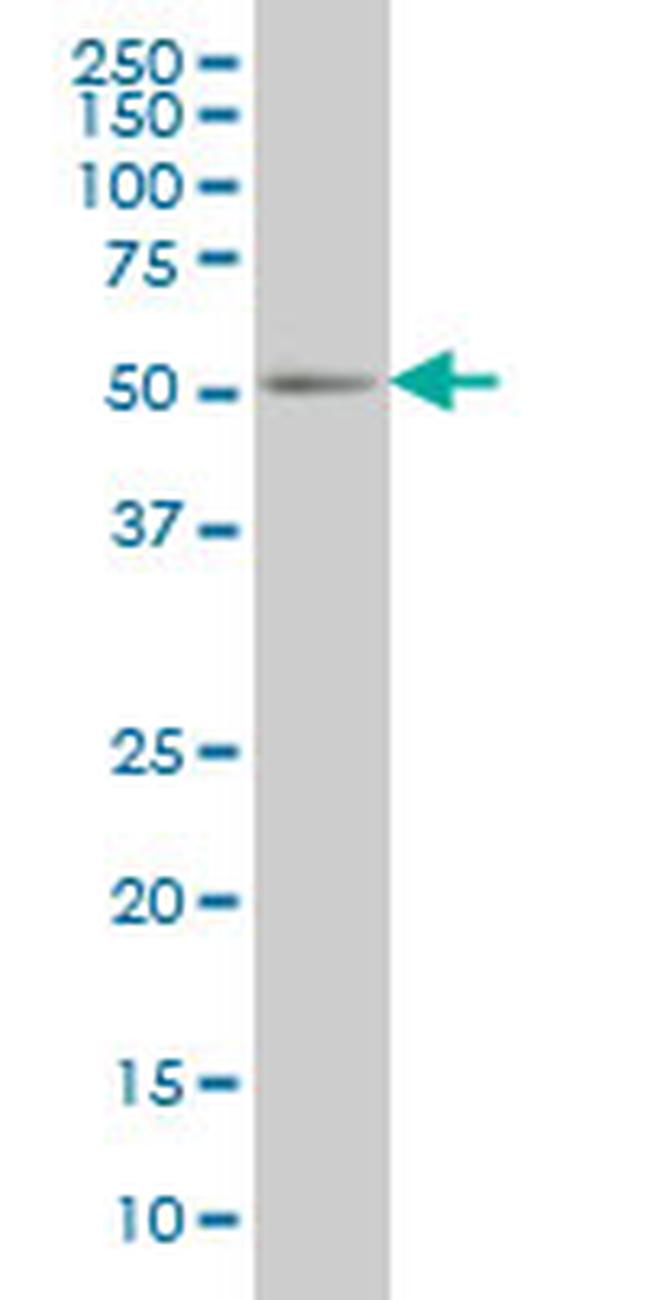 PEPD Antibody in Western Blot (WB)